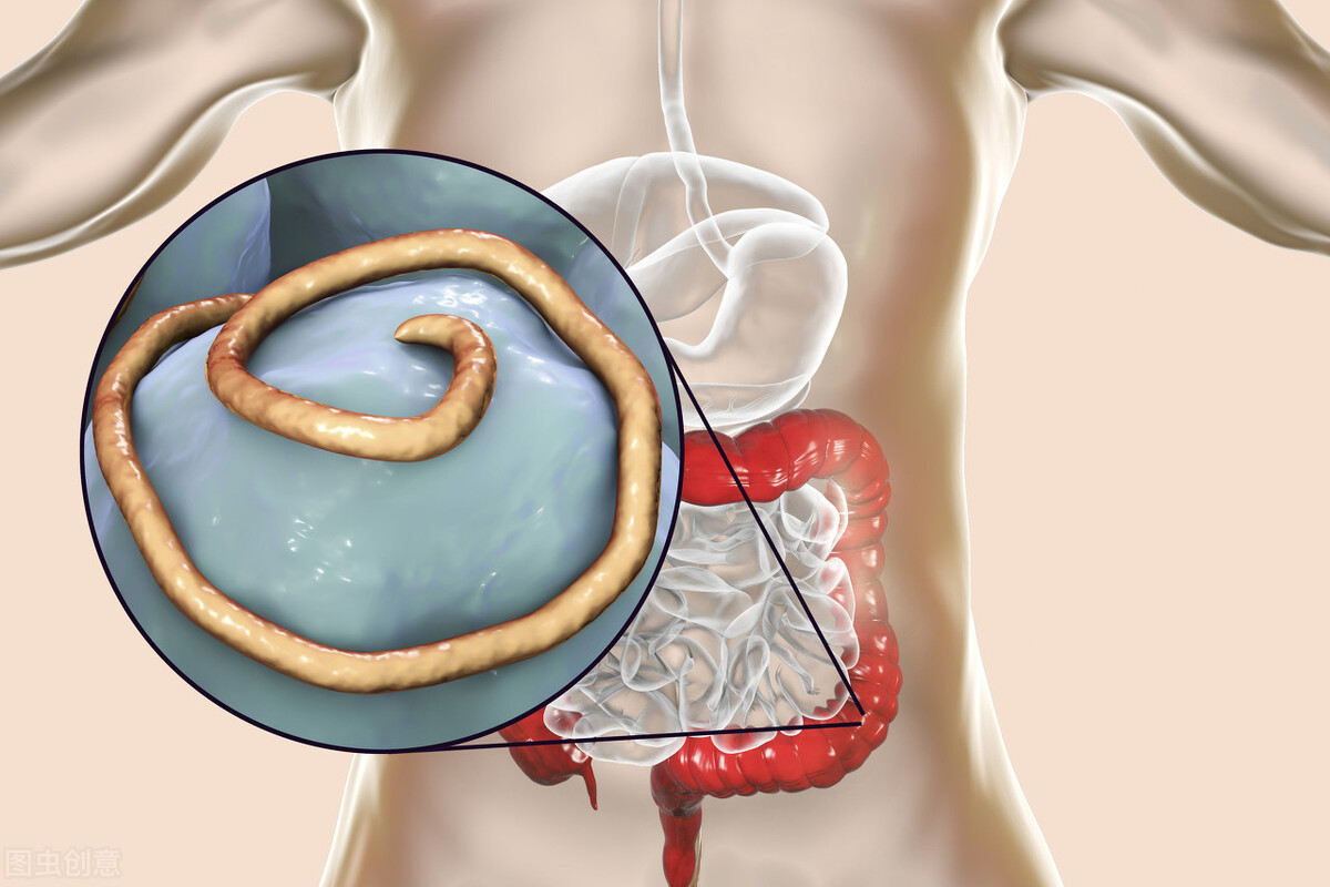 在你肚子一天产卵20万个，将阑尾打穿，蛔虫的可怕还记得吗？
